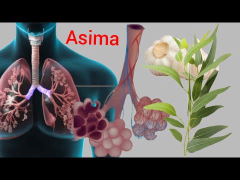 Indwara ya asima; umuti wayo, Ibyo kwirindwa, ibiribwa byo kwibandaho.