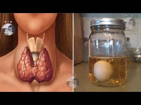 Këto janë shenjat që trupi ju jep kur keni probleme me tiroiden, ja si ta trajtoni