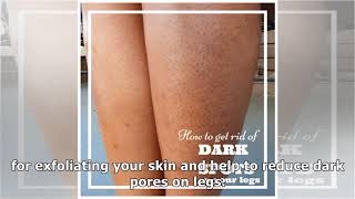 How to Get Rid of Dark Pores on Legs (Strawberry Legs)