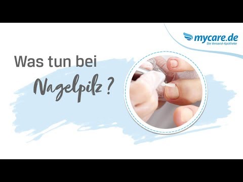 Die dunklen Nägel auf den Beinen der Grund und die Behandlung Als es ist am besten, gribok der Nägel auf den Händen zu behandeln