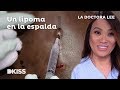 La doctora Lee extrae un lipoma situado encima de la médula La doctora Lee extrae un lipoma situado encima de la médula