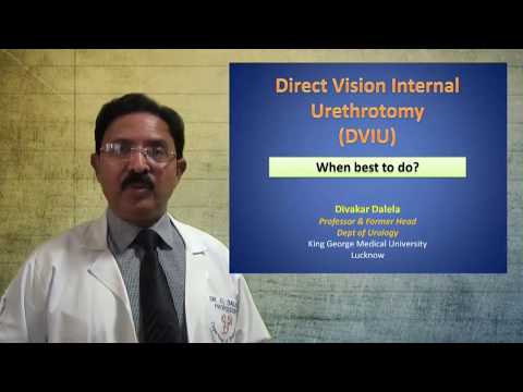 Direct Vision Internal Urethrotomy - When best to do?