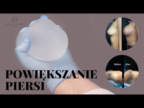 Piotr  Turkowski-55