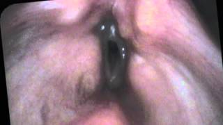 Basic Laryngology: Mind the Gap — Part 3