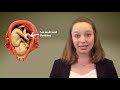 Umbilical Cord Prolapse