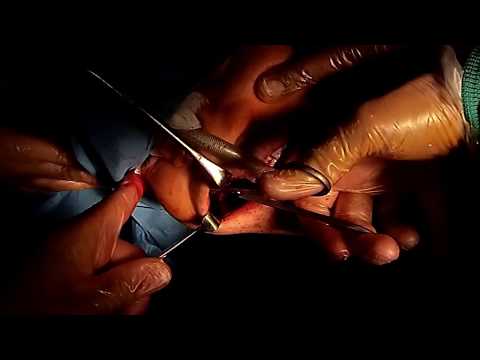 Aumento della potenza sessuale prezzo Lovelace Come per eccitare un uomo con limpotenza