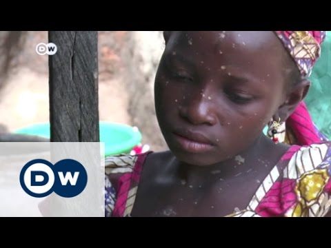 Nigeria: Tödliche Kinderarbeit in Minen | DW Nachrichten