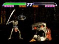 KIGOLD N64 Spinal No Mercy