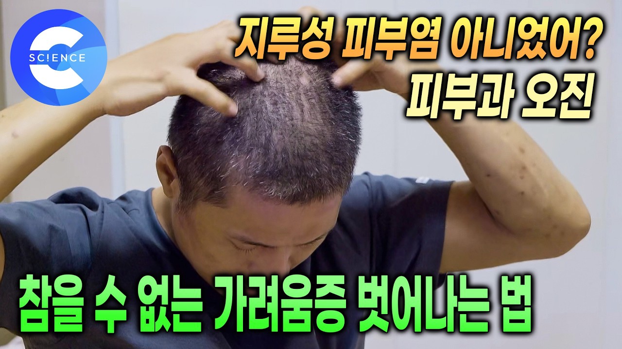 피부과 오진으로 5년 동안 잘못알고 있었던 두피질환 | 일상생활에 지장을 주는 심각한 두피질환, 치료 방법은 뭘까? | 올바른 샴푸 사용법 | 귀하신몸