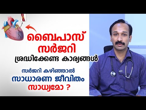 ബൈപാസ് സർജറി ശ്രദ്ധിക്കേണ്ട കാര്യങ്ങൾ | Heart bypass surgery | Dr. Sisir Balakrishna Pillai