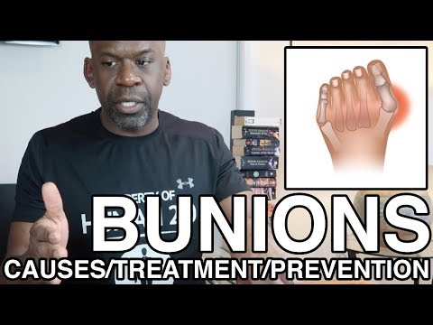BUNIONS (HALLUX VALGUS): Causes, Treatment & Prevention Explained By Dr. Chris Raynor | Human 2.0