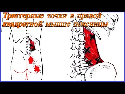 Конская мазь для суставов в польше Народные средства для лечения невралгии плечевого сустава