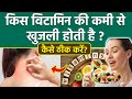 Kis Vitamin Ki Vajah Se Khujli Hoti Hai Skin Itching Problem Solution Vitamin Deficiency