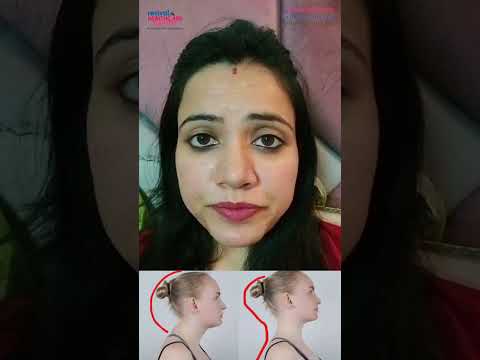What is neck hump?
