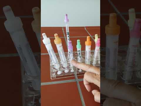 SCHEF Regel zur venösen Blutentnahme - Monovetten System(Sarstedt)