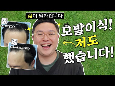 탈모 고민? '나는 모발이식까지는 필요 없겠지?!' 라고 생각하는 분들 들어오세요