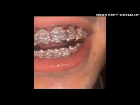 (FREE) MOSQUIT X KIZARU X METRO BOOMIN TYPE BEAT - VERSACE(Prod. SkinnyX)