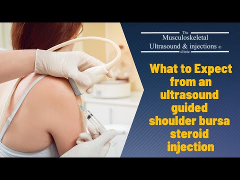 What to expcet from an ultrasound guided Shoulder bursitis steroid injection