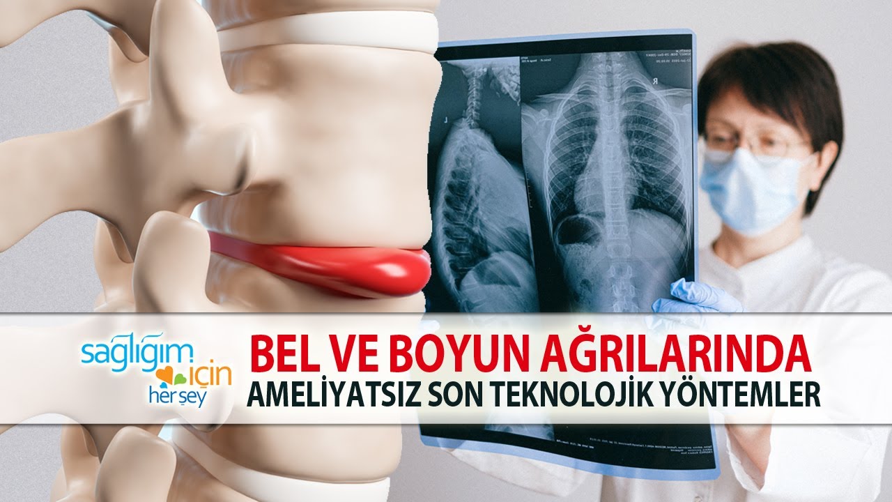 Bel ve Boyun Fıtıklarında Son Teknolojik Ameliyatsız Yöntemler