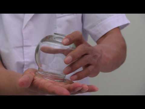 Chinese Glass Cupping Therapy - How to Create Suction Using Fire