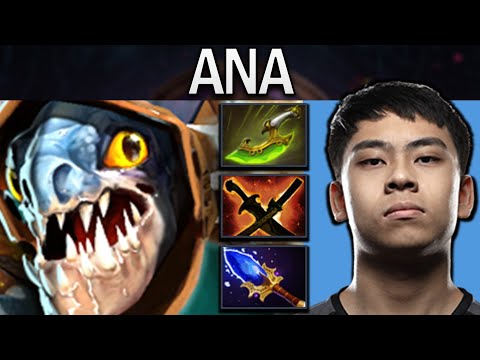 Slark Dota 2 Gameplay Ana with Swift Blink - SNY