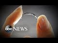 Bayer to no longer sell permanent birth control implant Essure