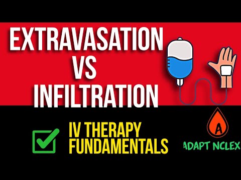NCLEX Fundamentals Review: IV Therapy Complications & Nursing Interventions