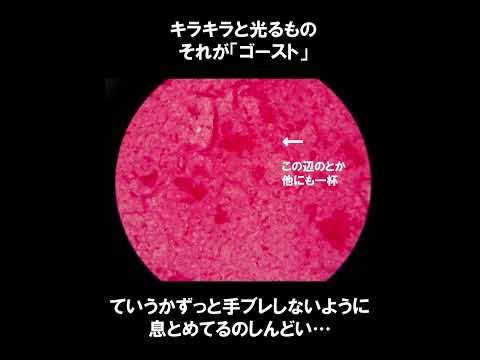 看護学科 グラム染色で見える抗酸菌の「ゴースト」
