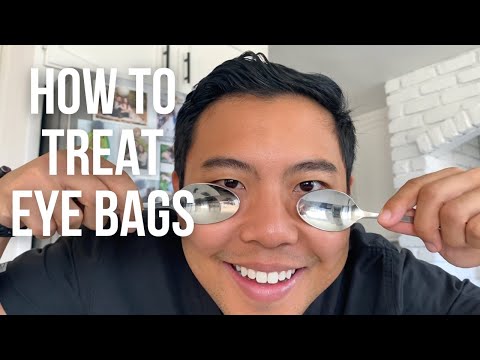 How to get rid of UNDER EYE BAGS FAST (the SAFEST ways) | 👁 Ophthalmologist @michaelchuamd