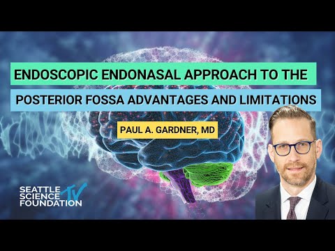 Endoscopic Endonasal Approach to the Posterior Fossa  Advantages and Limitations - Paul Gardner, MD