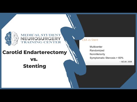 Carotid Endarterectomy vs. Stenting