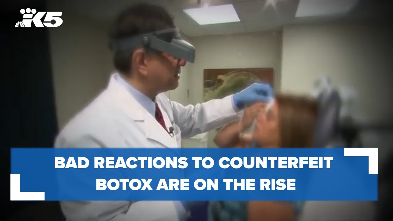 Bad reactions to fake Botox on the rise