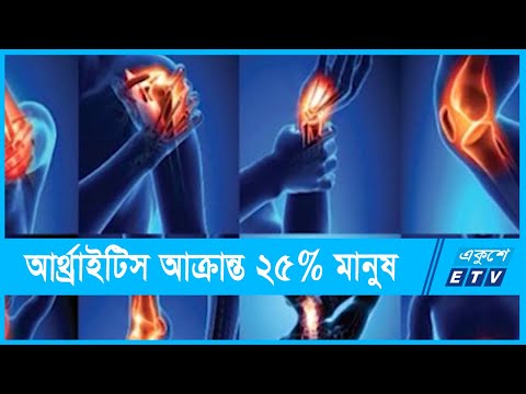 দেশে ২৫ শতাংশ মানুষ আর্থ্রাইটিস আক্রান্ত