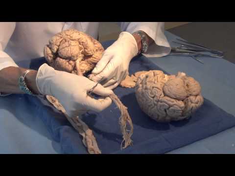 Three Critical Vertical Pathways: Neuroanatomy Video Lab - Brain Dissections