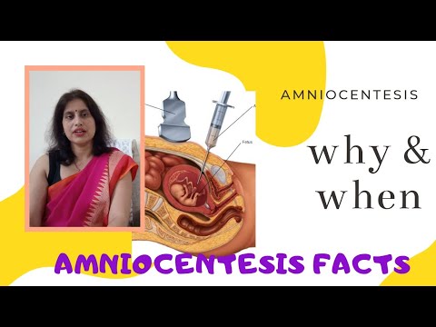 Amniocentesis — when, why and cost