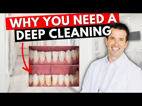 Prophy vs. Deep Cleaning...What's the difference? | Healthy Mouth Dental Cleaning vs. SRP