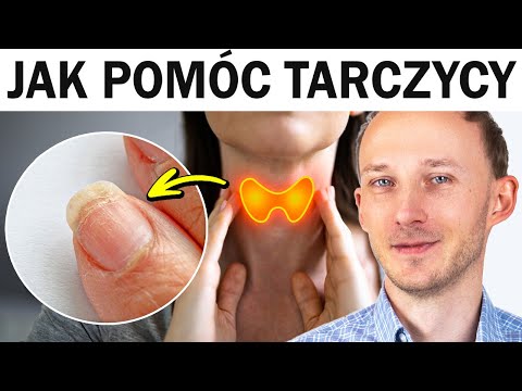 Oznaki, że tarczyca niedomaga 👉 Te składniki jej pomogą