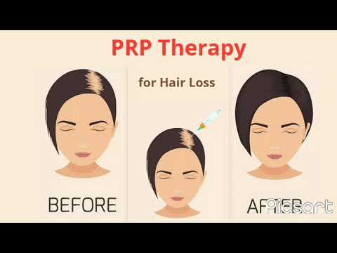 PRP TREATMENT