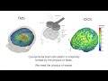 Online Neuromodulation | Plasticity, nfb & nMod