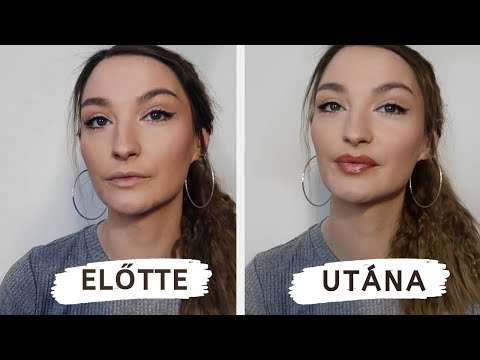 mag citrát fogyni