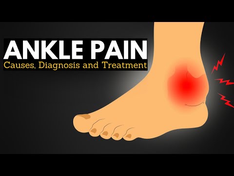Ankle Pain Survival Guide: Walking Comfortably Through Causes and Treatments