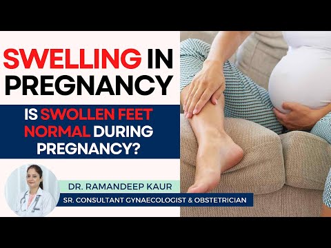 Swelling in Pregnancy | Swollen legs & Feet | What's Normal & When to Worry | Healing Hospital