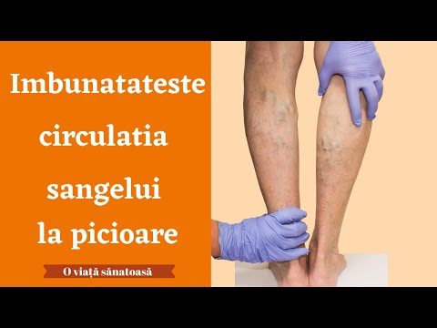 Cel mai bun medicament pentru durerile de genunchi