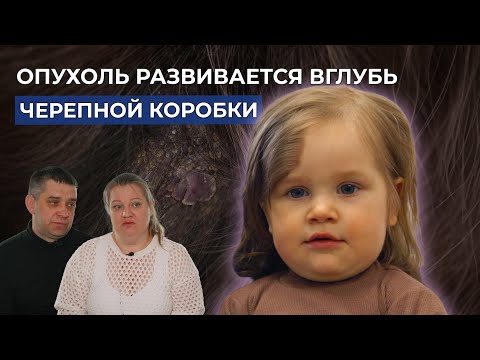 НЕВУС ВОЛОСИСТОЙ ЧАСТИ ГОЛОВЫ | История Ксюши Голубёнковой