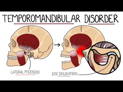 Temporomandibular Joint Disorder Explained (TMJ Dysfunction) | Includes Treatment & Anatomy
