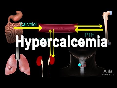 Hypercalcemia - Too Much Calcium, Animation