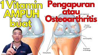 Download lagu 1 Vitamin AMPUH buat pengapuran / osteoarthritis ! mp3