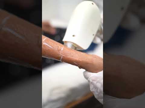 The Power of Laser Hair Removal Revealed at Khoobsurat Unisex Salon!