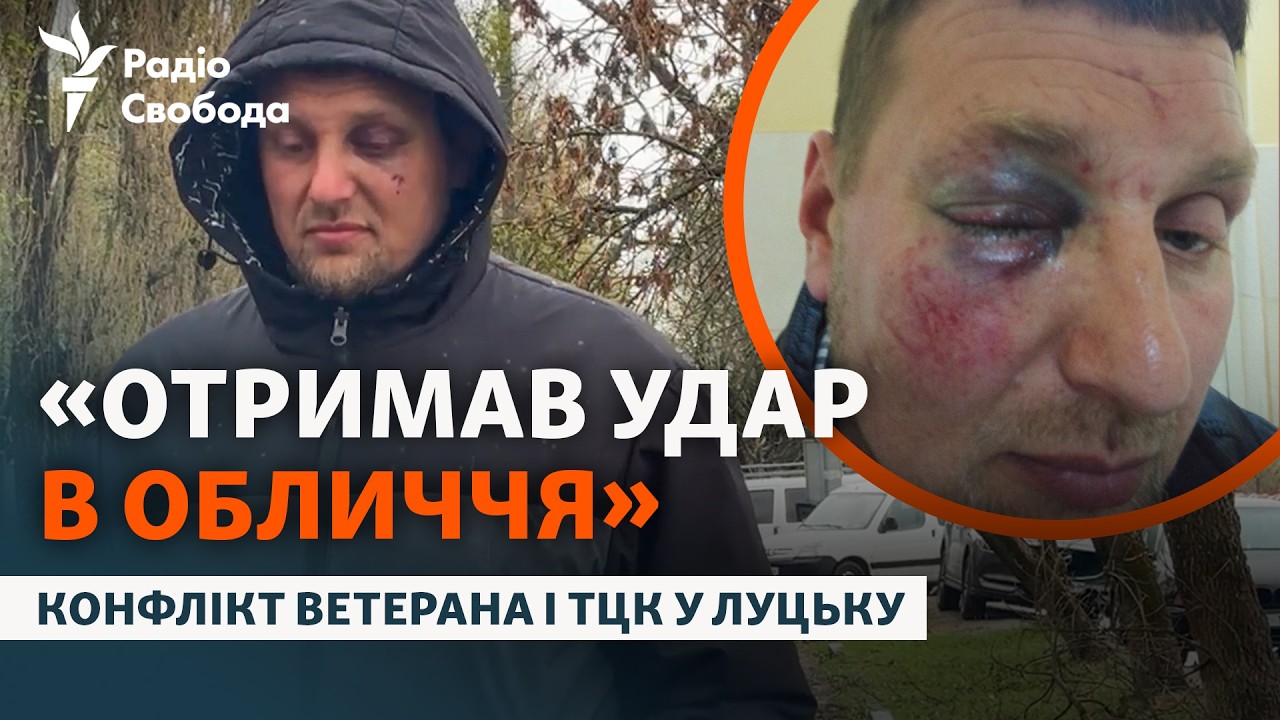 Конфлікт ексвійськового і ТЦК: «Вдарили в обличчя і кинули як ганчірку в маш?