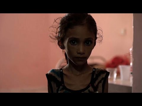 Krieg in Jemen: 5,2 Millionen Kinder leiden Hunger